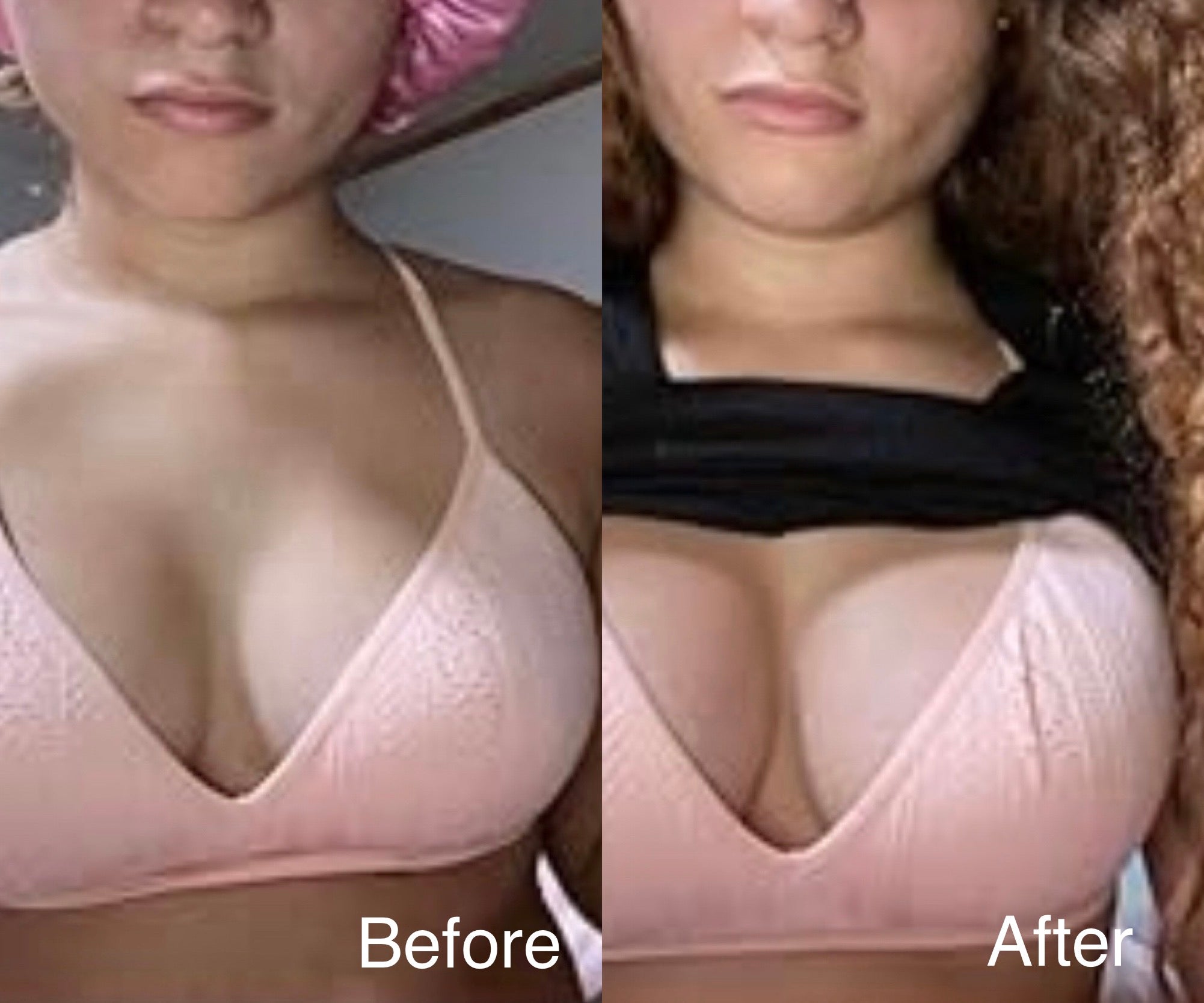 Busty Cup Breast Enhancement Gummies ShapelyU