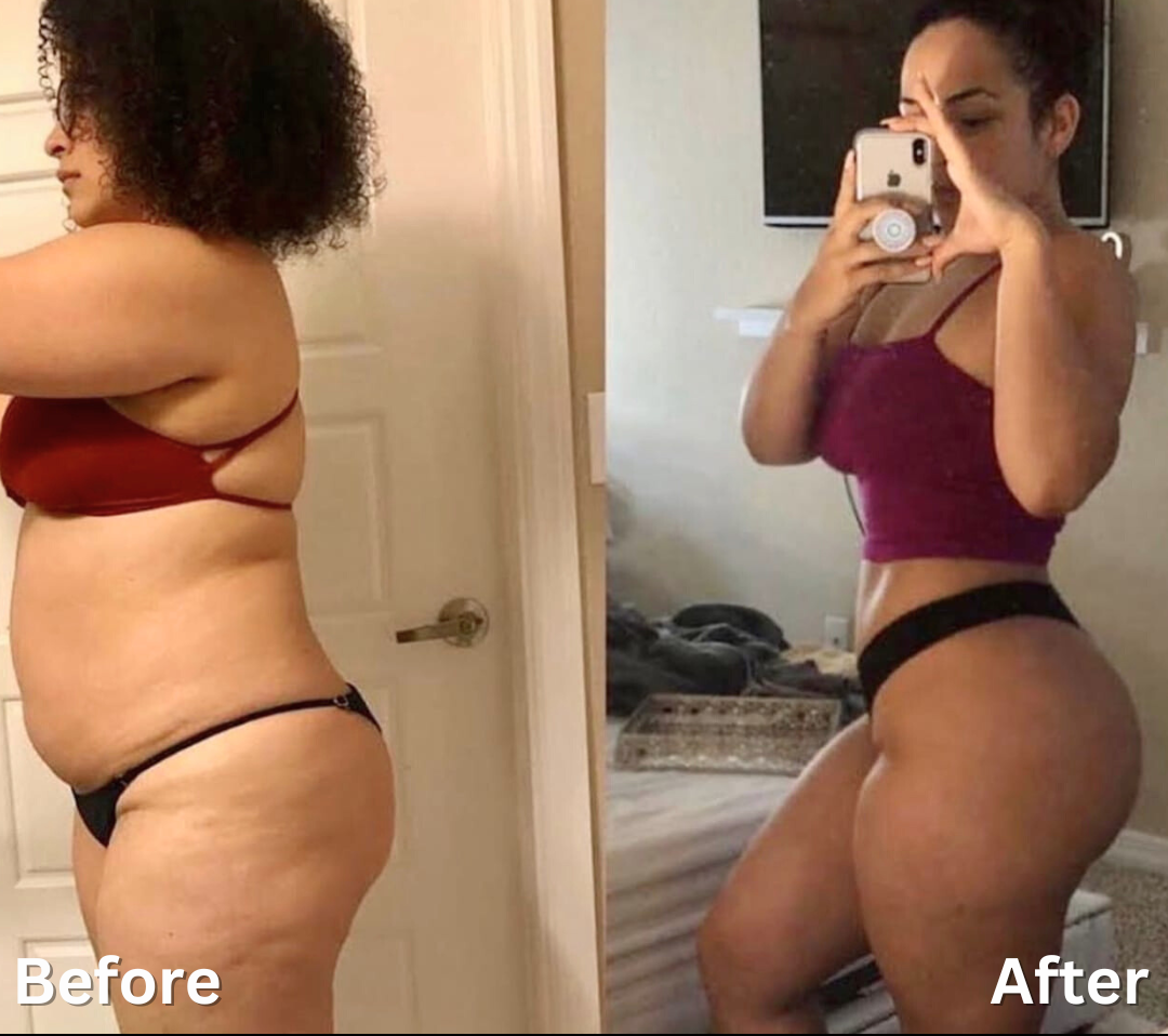 The Ultimate Body Bundle ShapelyU